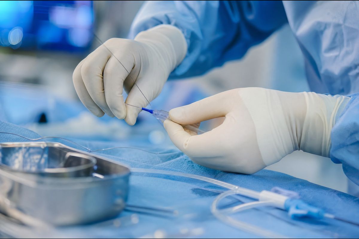 Hands in sterile gloves guiding a thin guidewire over a sterile drape